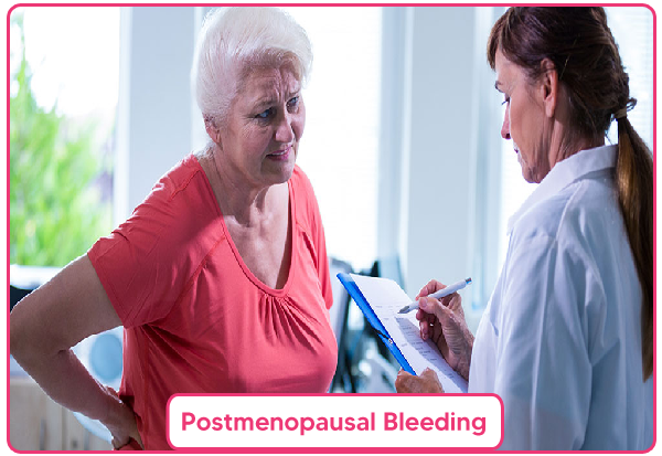 Postmenopausal Bleeding