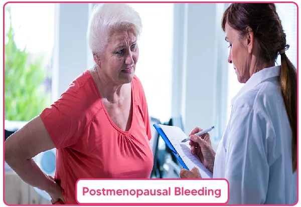 Postmenopausal Bleeding