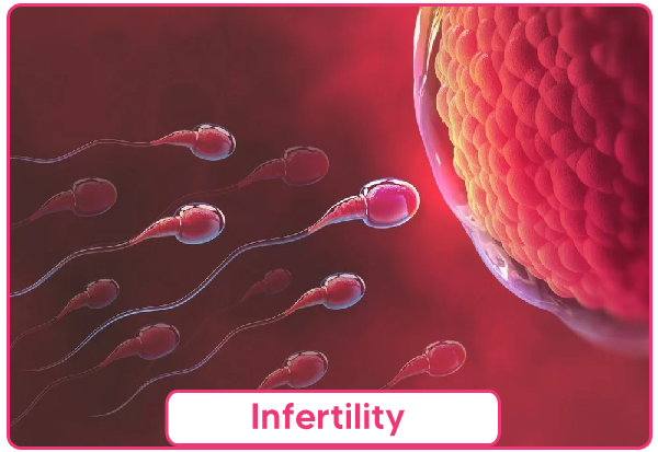 Infertility