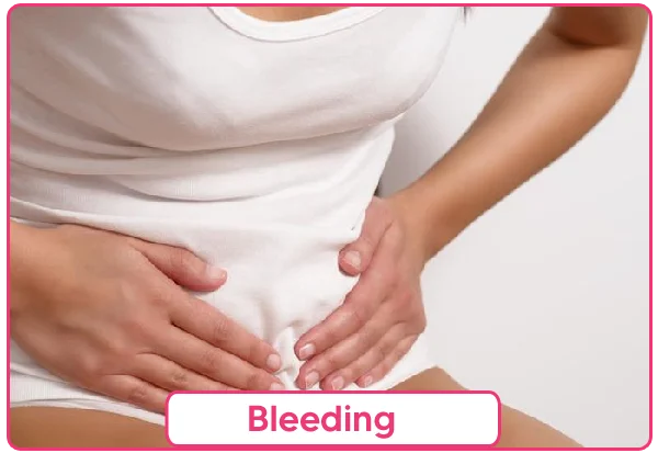 Bleeding