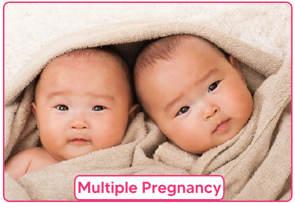 Multiple pregnancy